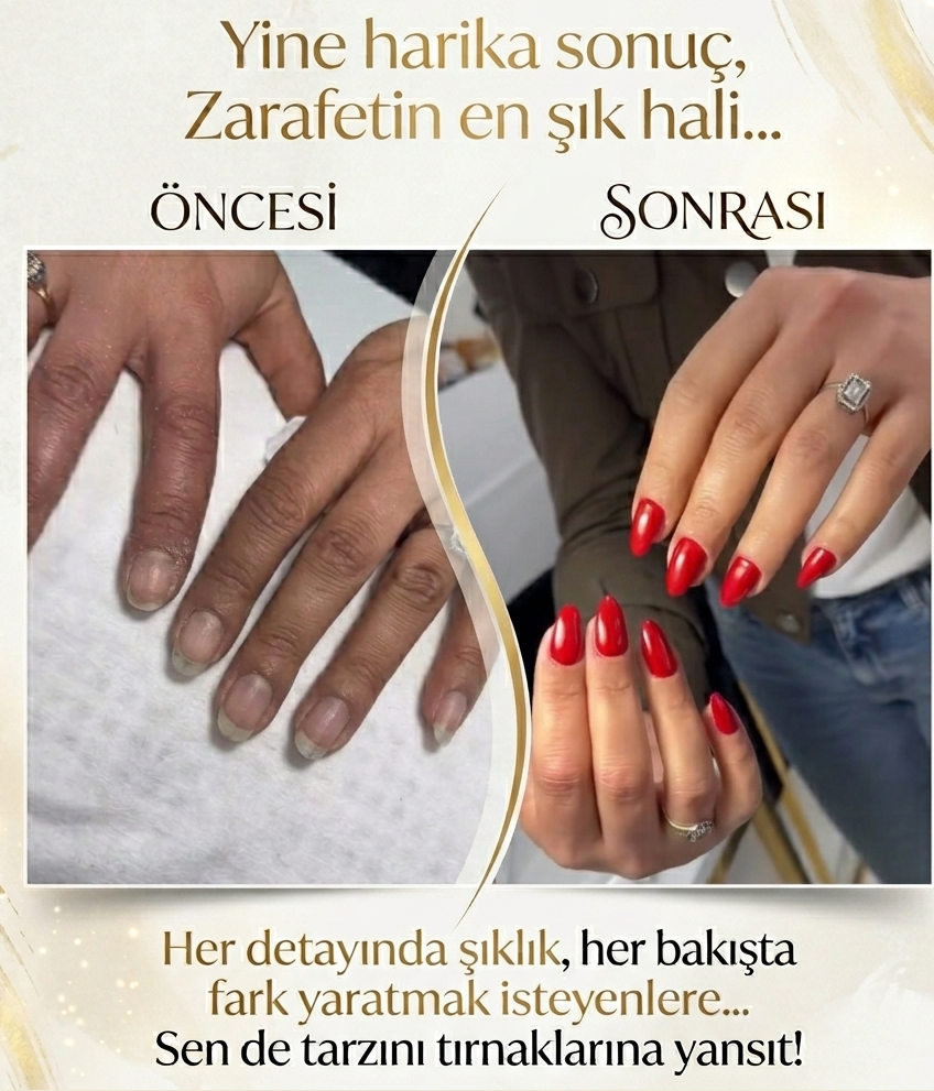 KALICI OJE KIZILAY 0543 462 45 11
