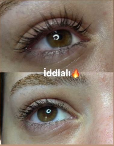 İpek Kirpik Kızılay 0543 462 45 11